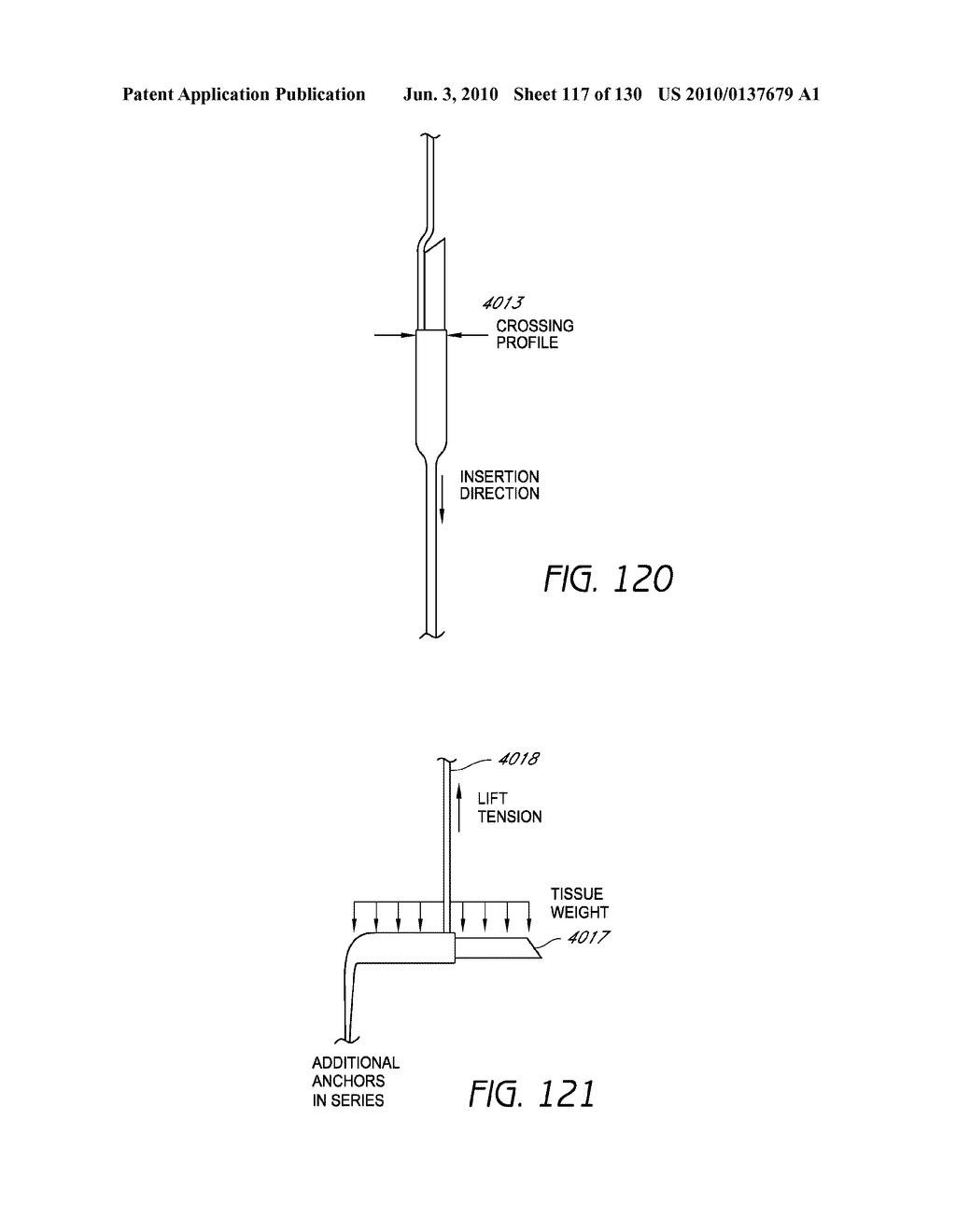 MINIMALLY INVASIVE BREAST LIFT METHOD WITH A SUPERIOR TISSUE SUPPORT AND AN INFERIOR ANCHOR - diagram, schematic, and image 118