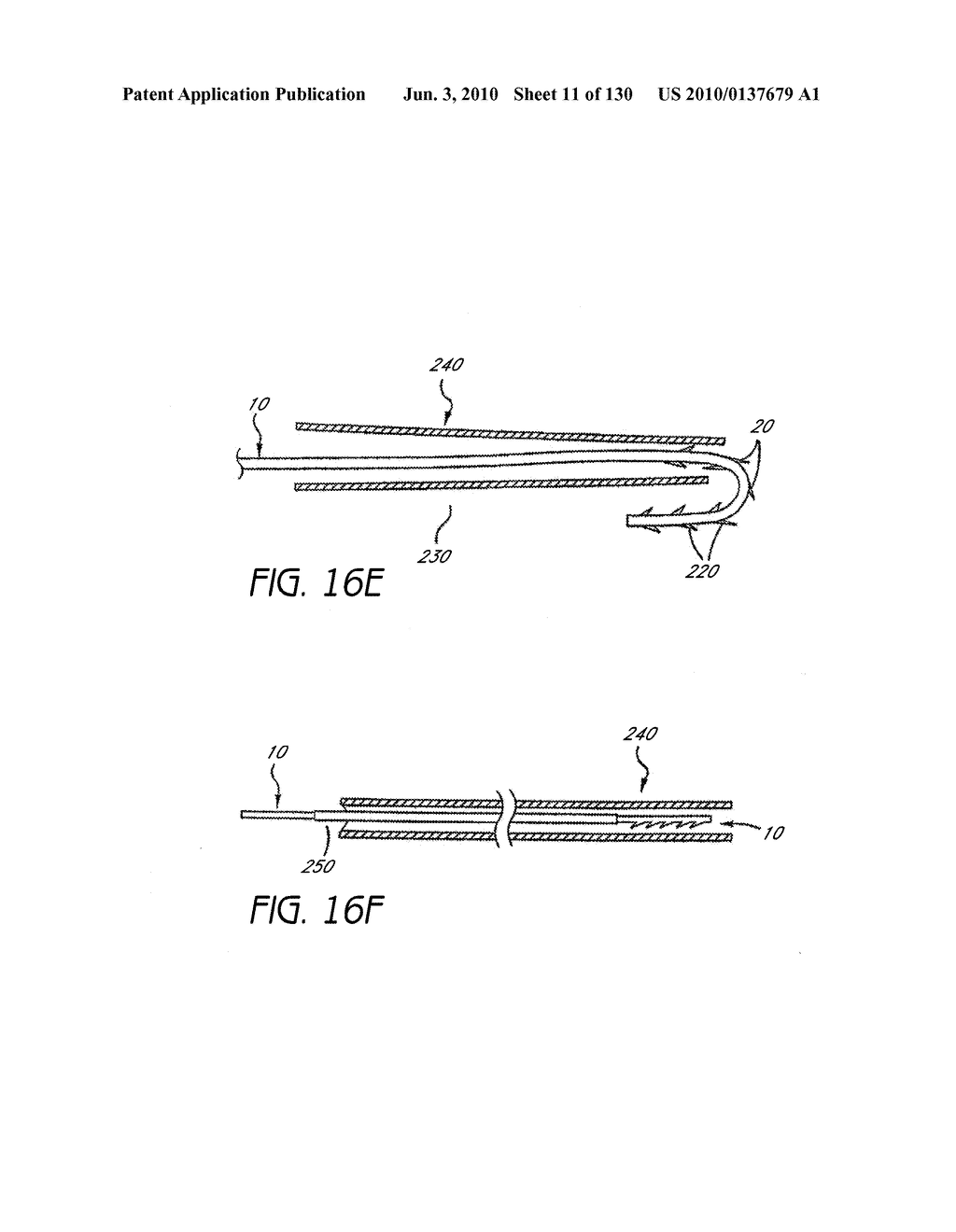 MINIMALLY INVASIVE BREAST LIFT METHOD WITH A SUPERIOR TISSUE SUPPORT AND AN INFERIOR ANCHOR - diagram, schematic, and image 12