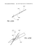 MINIMALLY INVASIVE BREAST LIFT METHOD WITH A SUPERIOR TISSUE SUPPORT AND AN INFERIOR ANCHOR diagram and image