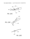 MINIMALLY INVASIVE BREAST LIFT METHOD WITH A SUPERIOR TISSUE SUPPORT AND AN INFERIOR ANCHOR diagram and image