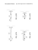 MINIMALLY INVASIVE BREAST LIFT METHOD WITH A SUPERIOR TISSUE SUPPORT AND AN INFERIOR ANCHOR diagram and image