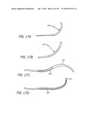 MINIMALLY INVASIVE BREAST LIFT METHOD WITH A SUPERIOR TISSUE SUPPORT AND AN INFERIOR ANCHOR diagram and image