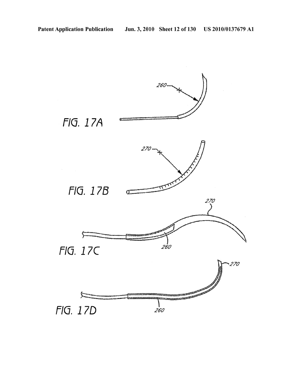 MINIMALLY INVASIVE BREAST LIFT METHOD WITH A SUPERIOR TISSUE SUPPORT AND AN INFERIOR ANCHOR - diagram, schematic, and image 13