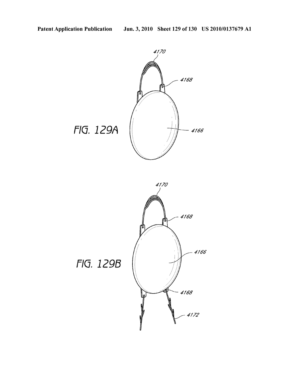 MINIMALLY INVASIVE BREAST LIFT METHOD WITH A SUPERIOR TISSUE SUPPORT AND AN INFERIOR ANCHOR - diagram, schematic, and image 130