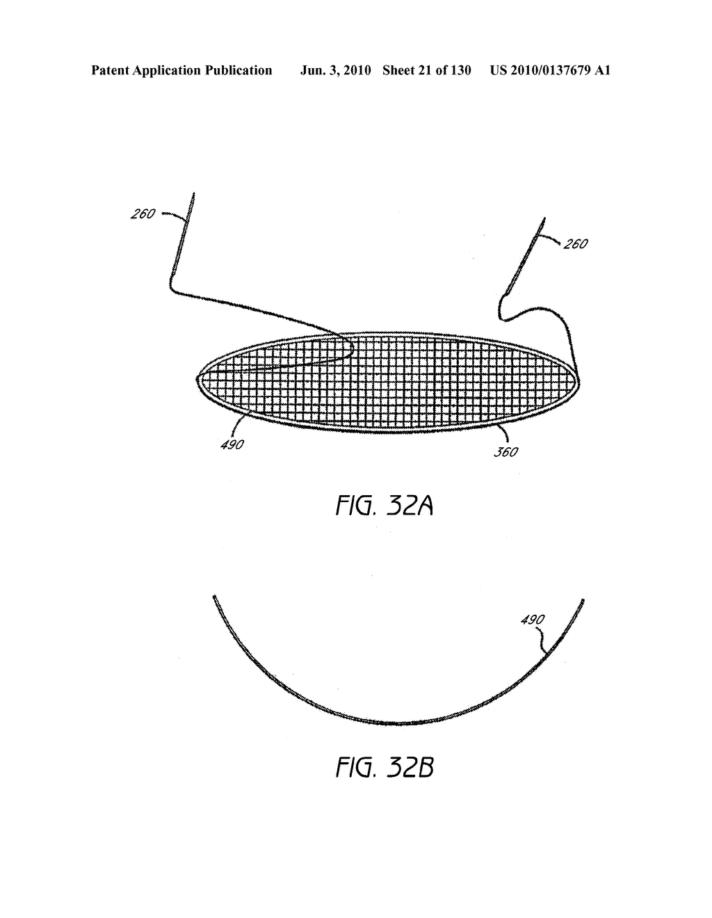 MINIMALLY INVASIVE BREAST LIFT METHOD WITH A SUPERIOR TISSUE SUPPORT AND AN INFERIOR ANCHOR - diagram, schematic, and image 22