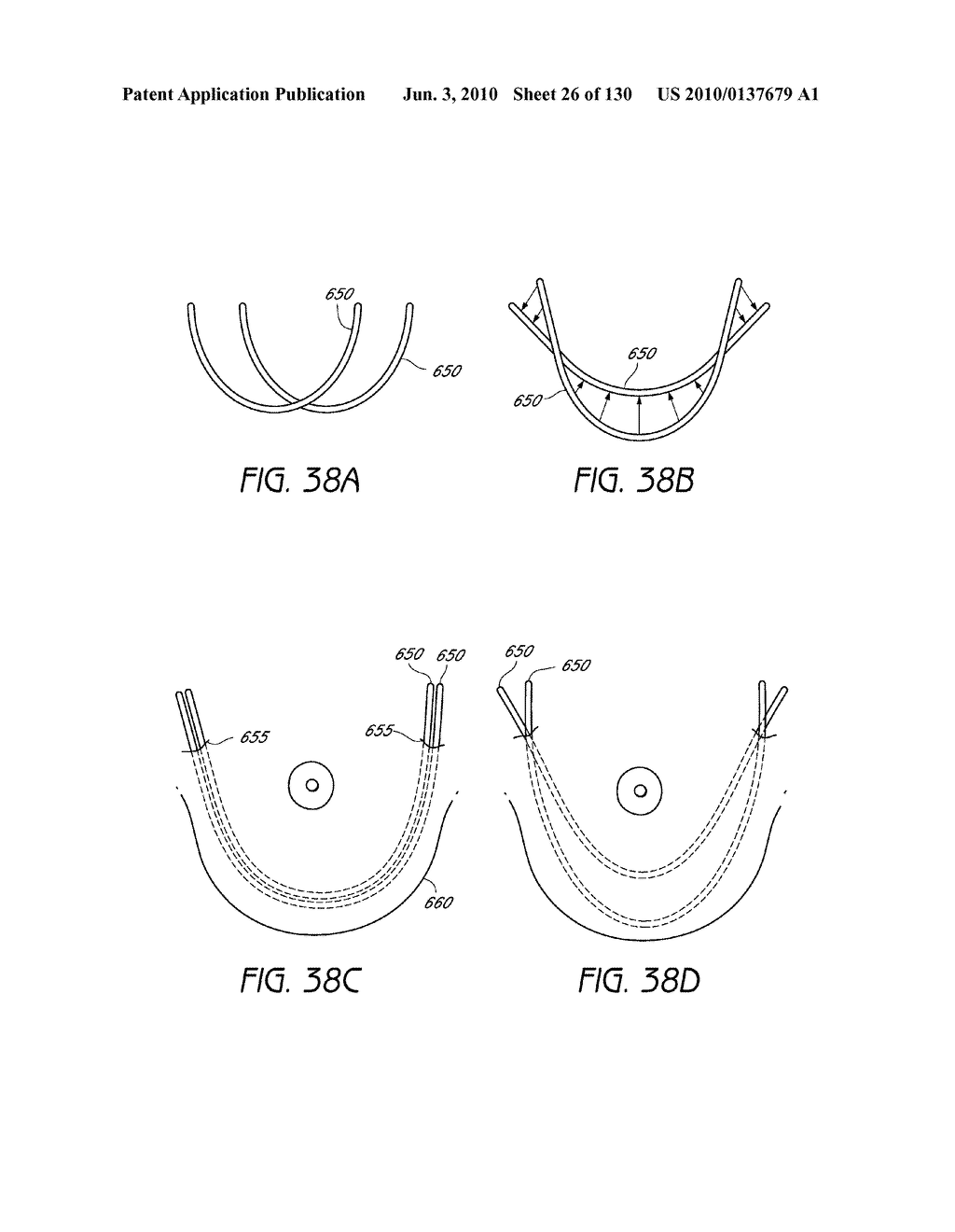 MINIMALLY INVASIVE BREAST LIFT METHOD WITH A SUPERIOR TISSUE SUPPORT AND AN INFERIOR ANCHOR - diagram, schematic, and image 27