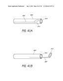 MINIMALLY INVASIVE BREAST LIFT METHOD WITH A SUPERIOR TISSUE SUPPORT AND AN INFERIOR ANCHOR diagram and image