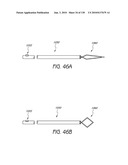 MINIMALLY INVASIVE BREAST LIFT METHOD WITH A SUPERIOR TISSUE SUPPORT AND AN INFERIOR ANCHOR diagram and image