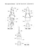 MINIMALLY INVASIVE BREAST LIFT METHOD WITH A SUPERIOR TISSUE SUPPORT AND AN INFERIOR ANCHOR diagram and image