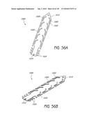 MINIMALLY INVASIVE BREAST LIFT METHOD WITH A SUPERIOR TISSUE SUPPORT AND AN INFERIOR ANCHOR diagram and image