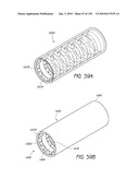 MINIMALLY INVASIVE BREAST LIFT METHOD WITH A SUPERIOR TISSUE SUPPORT AND AN INFERIOR ANCHOR diagram and image