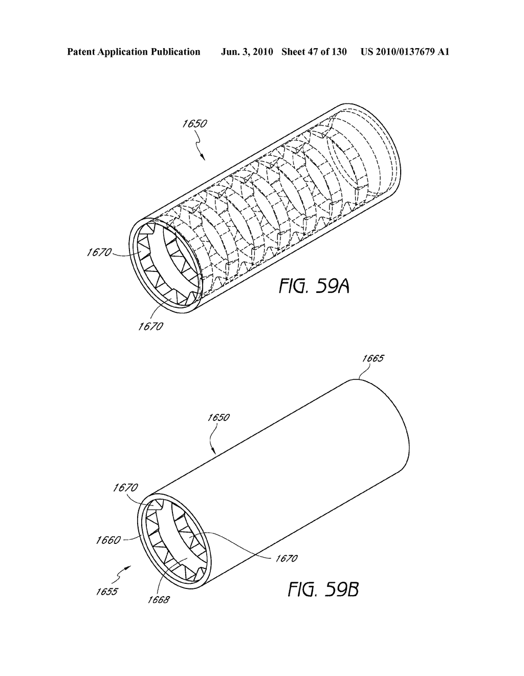 MINIMALLY INVASIVE BREAST LIFT METHOD WITH A SUPERIOR TISSUE SUPPORT AND AN INFERIOR ANCHOR - diagram, schematic, and image 48