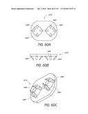 MINIMALLY INVASIVE BREAST LIFT METHOD WITH A SUPERIOR TISSUE SUPPORT AND AN INFERIOR ANCHOR diagram and image