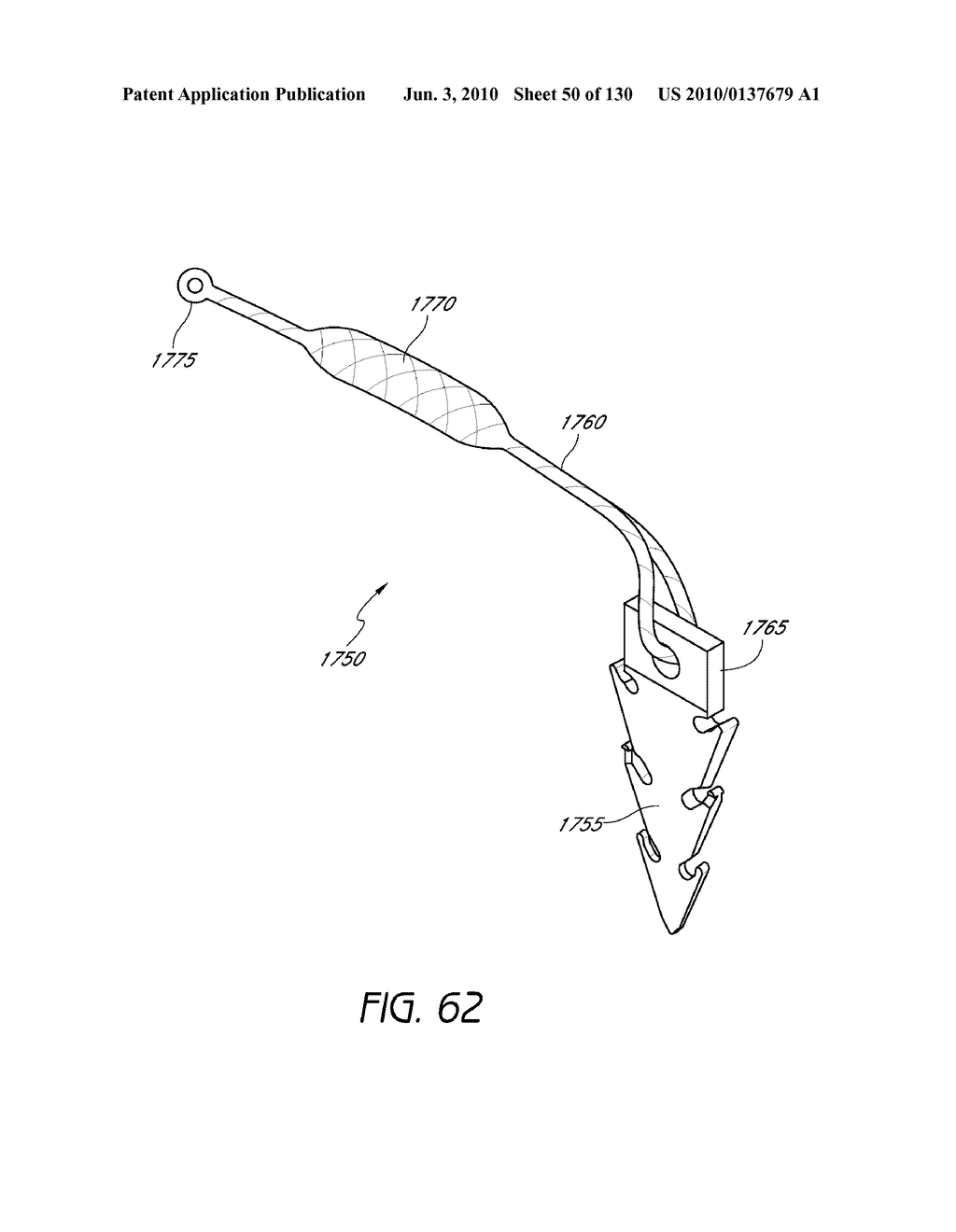 MINIMALLY INVASIVE BREAST LIFT METHOD WITH A SUPERIOR TISSUE SUPPORT AND AN INFERIOR ANCHOR - diagram, schematic, and image 51