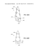 MINIMALLY INVASIVE BREAST LIFT METHOD WITH A SUPERIOR TISSUE SUPPORT AND AN INFERIOR ANCHOR diagram and image