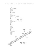 MINIMALLY INVASIVE BREAST LIFT METHOD WITH A SUPERIOR TISSUE SUPPORT AND AN INFERIOR ANCHOR diagram and image