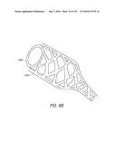 MINIMALLY INVASIVE BREAST LIFT METHOD WITH A SUPERIOR TISSUE SUPPORT AND AN INFERIOR ANCHOR diagram and image