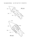 MINIMALLY INVASIVE BREAST LIFT METHOD WITH A SUPERIOR TISSUE SUPPORT AND AN INFERIOR ANCHOR diagram and image