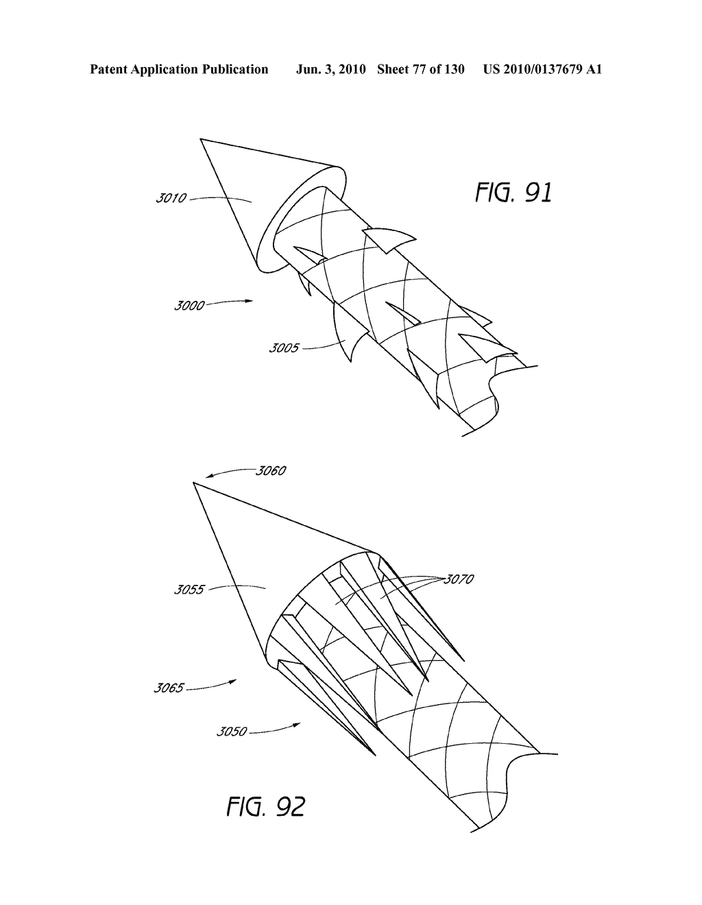 MINIMALLY INVASIVE BREAST LIFT METHOD WITH A SUPERIOR TISSUE SUPPORT AND AN INFERIOR ANCHOR - diagram, schematic, and image 78