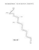 MINIMALLY INVASIVE BREAST LIFT METHOD WITH A SUPERIOR TISSUE SUPPORT AND AN INFERIOR ANCHOR diagram and image