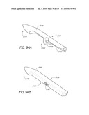 MINIMALLY INVASIVE BREAST LIFT METHOD WITH A SUPERIOR TISSUE SUPPORT AND AN INFERIOR ANCHOR diagram and image