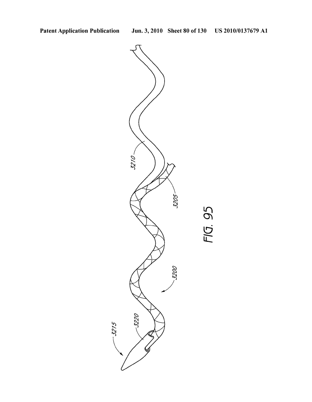 MINIMALLY INVASIVE BREAST LIFT METHOD WITH A SUPERIOR TISSUE SUPPORT AND AN INFERIOR ANCHOR - diagram, schematic, and image 81