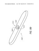 MINIMALLY INVASIVE BREAST LIFT METHOD WITH A SUPERIOR TISSUE SUPPORT AND AN INFERIOR ANCHOR diagram and image