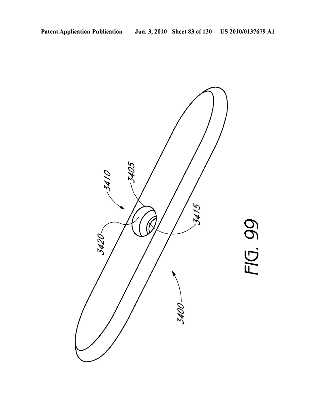 MINIMALLY INVASIVE BREAST LIFT METHOD WITH A SUPERIOR TISSUE SUPPORT AND AN INFERIOR ANCHOR - diagram, schematic, and image 84