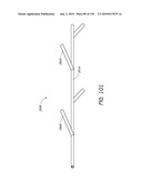 MINIMALLY INVASIVE BREAST LIFT METHOD WITH A SUPERIOR TISSUE SUPPORT AND AN INFERIOR ANCHOR diagram and image