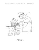 Endotracheal intubation device diagram and image