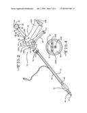 Endotracheal intubation device diagram and image