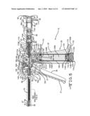 Endotracheal intubation device diagram and image