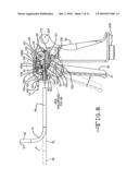 Endotracheal intubation device diagram and image