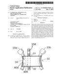 Laparoscopic instrument and trocar systems for trans-umbilical laparoscopic surgery diagram and image