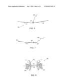 Laparoscopic instrument and trocar systems for trans-umbilical laparoscopic surgery diagram and image