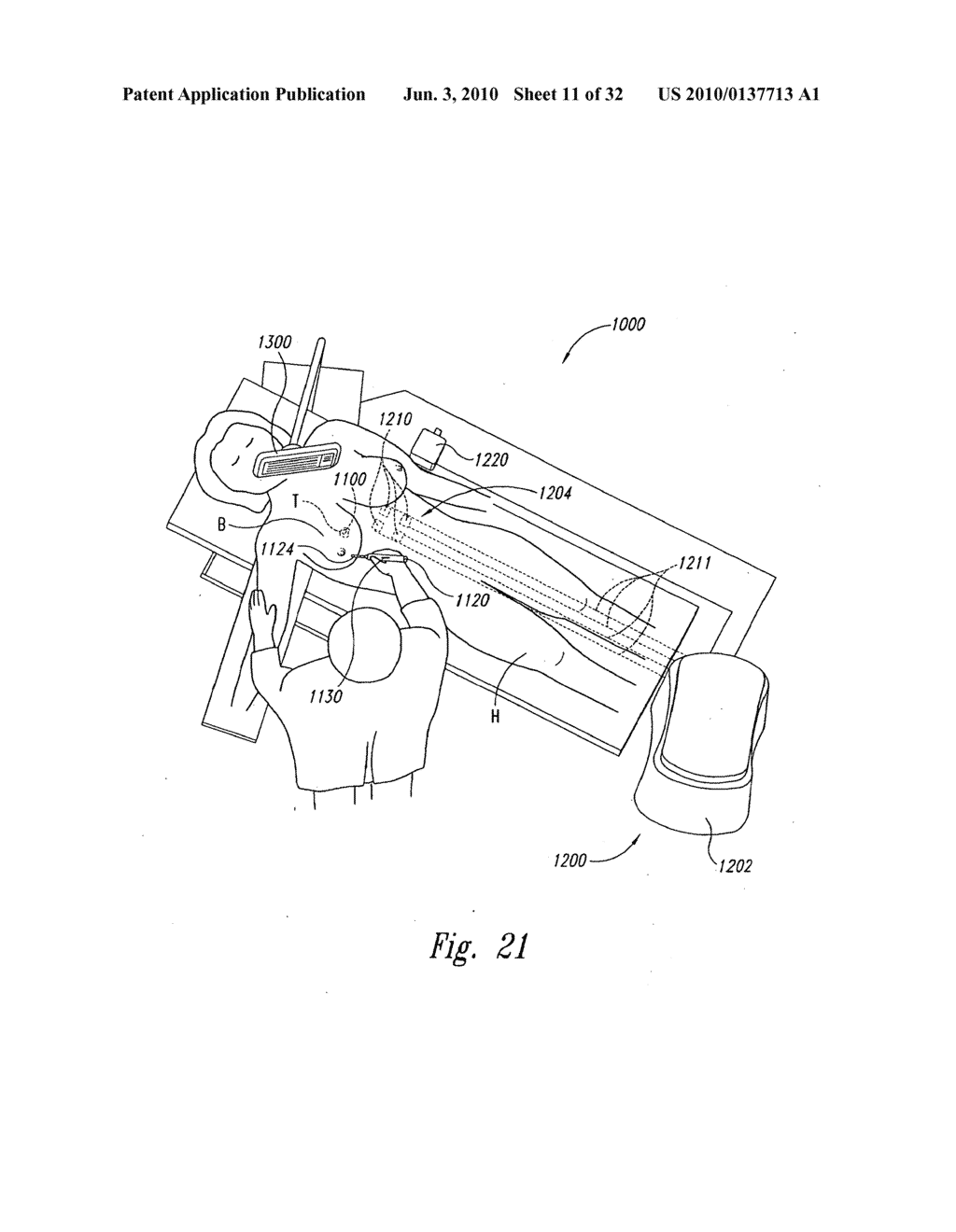 SYSTEMS AND METHODS FOR STABILIZING A TARGET LOCATION WITHIN A HUMAN BODY - diagram, schematic, and image 12