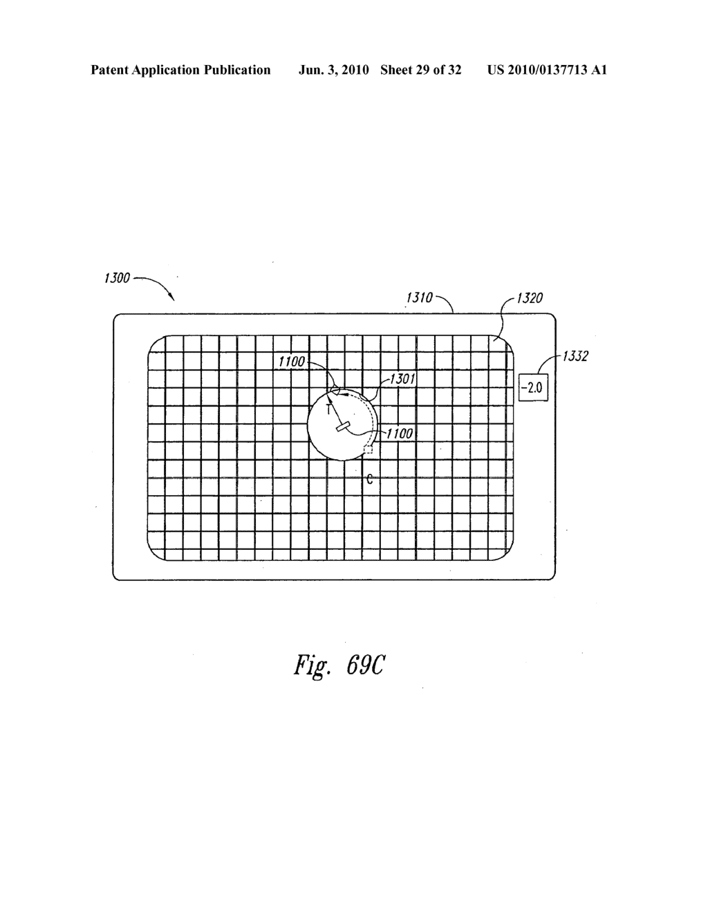 SYSTEMS AND METHODS FOR STABILIZING A TARGET LOCATION WITHIN A HUMAN BODY - diagram, schematic, and image 30