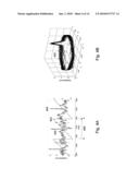 EXTRACTION OF FETAL CARDIAC SIGNALS diagram and image