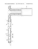 APPARATUS AND METHOD TO ACCESS THE BONE MARROW FOR ONCOLOGY AND STEM CELL APPLICATIONS diagram and image