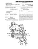 Pharyngeal wall treatment diagram and image