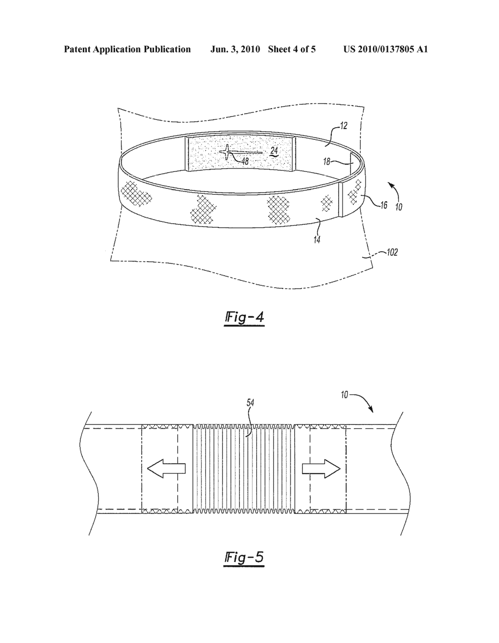 APPARATUS FOR SECURING AN INVASIVE TUBE TO A BODY - diagram, schematic, and image 05