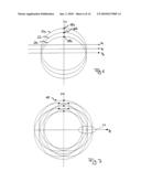 MULTIPLE-SPOT LASER REFRACTIVE OPHTHALMIC SURGERY diagram and image