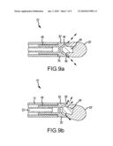 IRRIGATED ABLATION CATHETER HAVING A FLEXIBLE MANIFOLD diagram and image