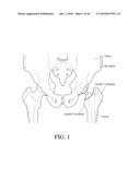 HIP SURGERY SYSTEMS AND METHODS diagram and image