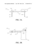 HIP SURGERY SYSTEMS AND METHODS diagram and image