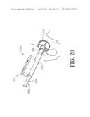 HIP SURGERY SYSTEMS AND METHODS diagram and image