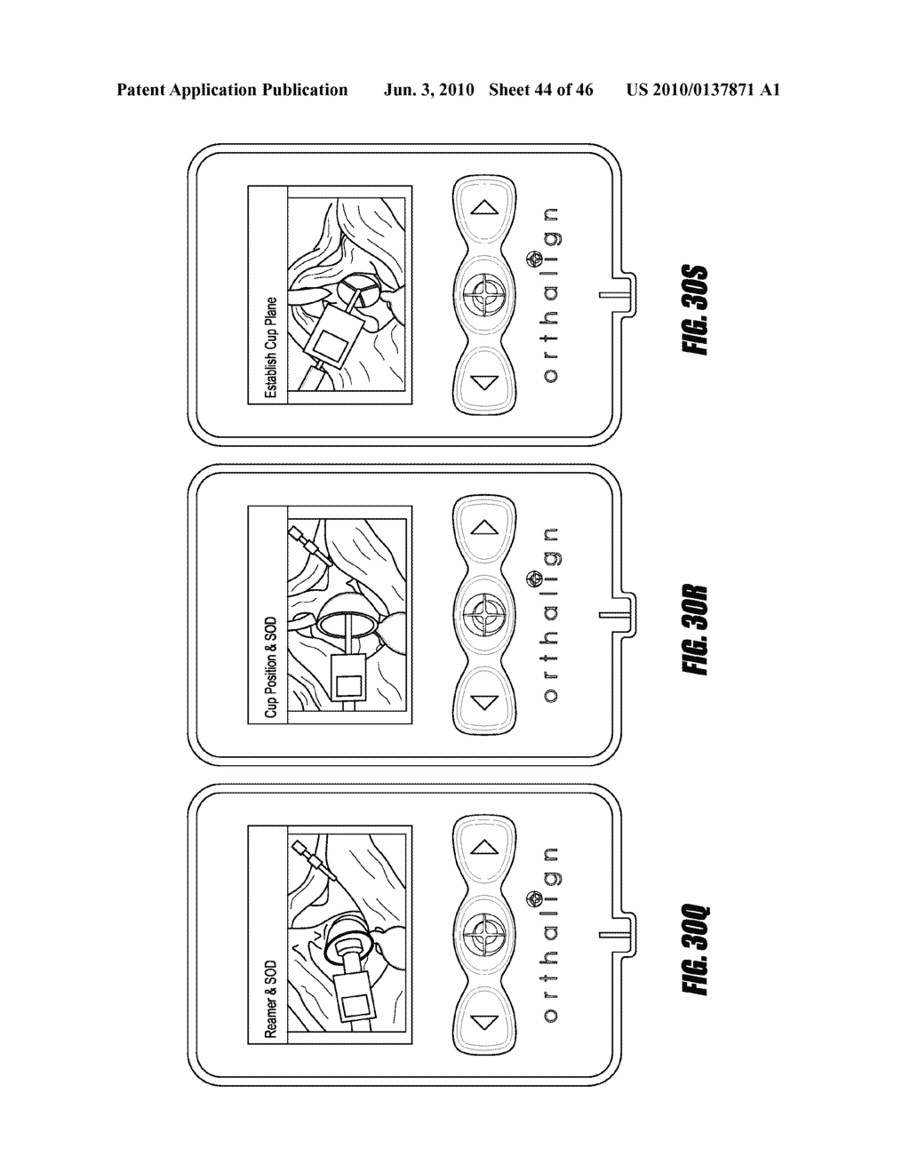 HIP SURGERY SYSTEMS AND METHODS - diagram, schematic, and image 45