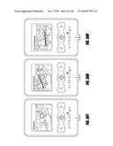 HIP SURGERY SYSTEMS AND METHODS diagram and image