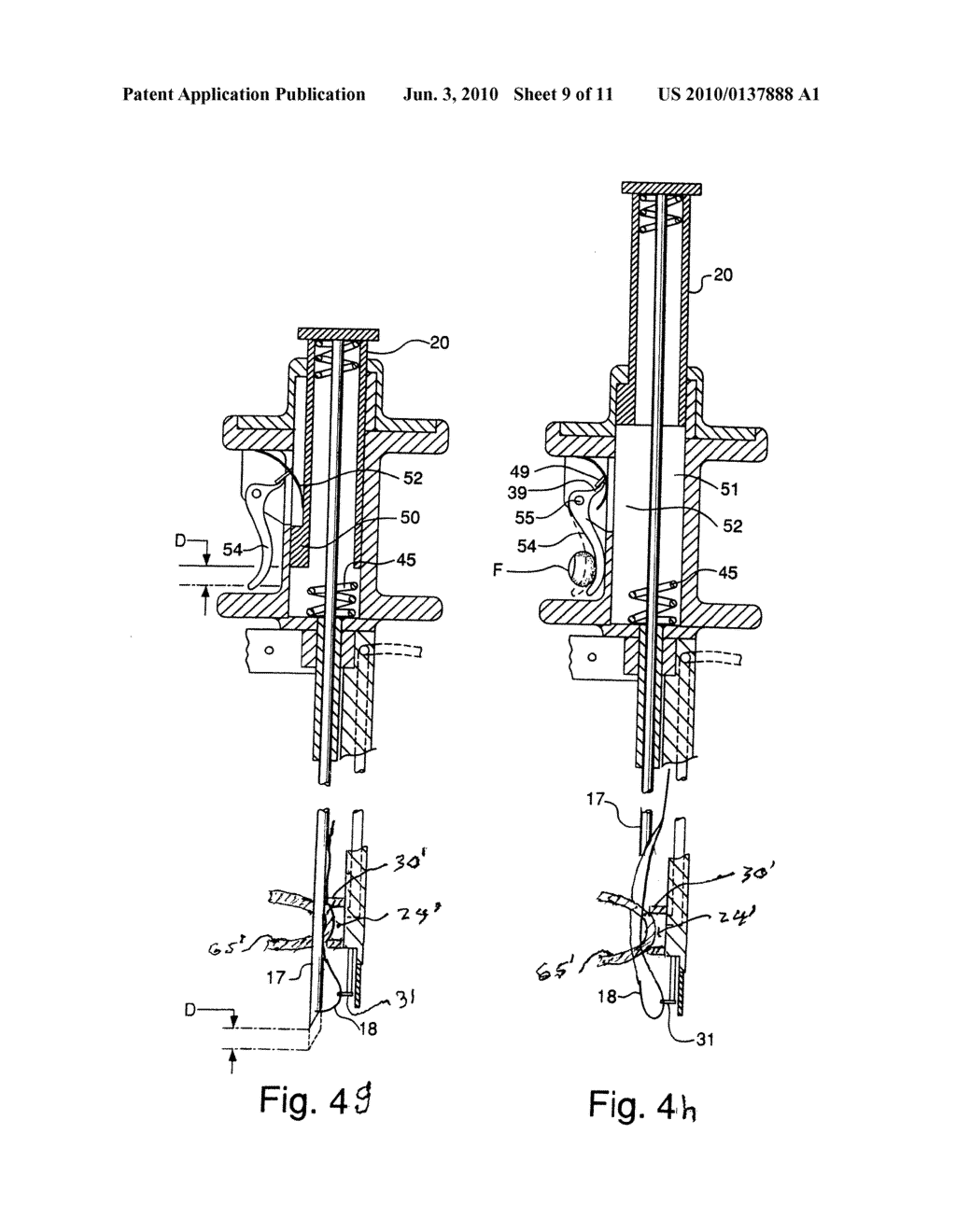 Surgical Instrument for Endoscopic Suturing of Deep Subcutaneous Tissue - diagram, schematic, and image 10