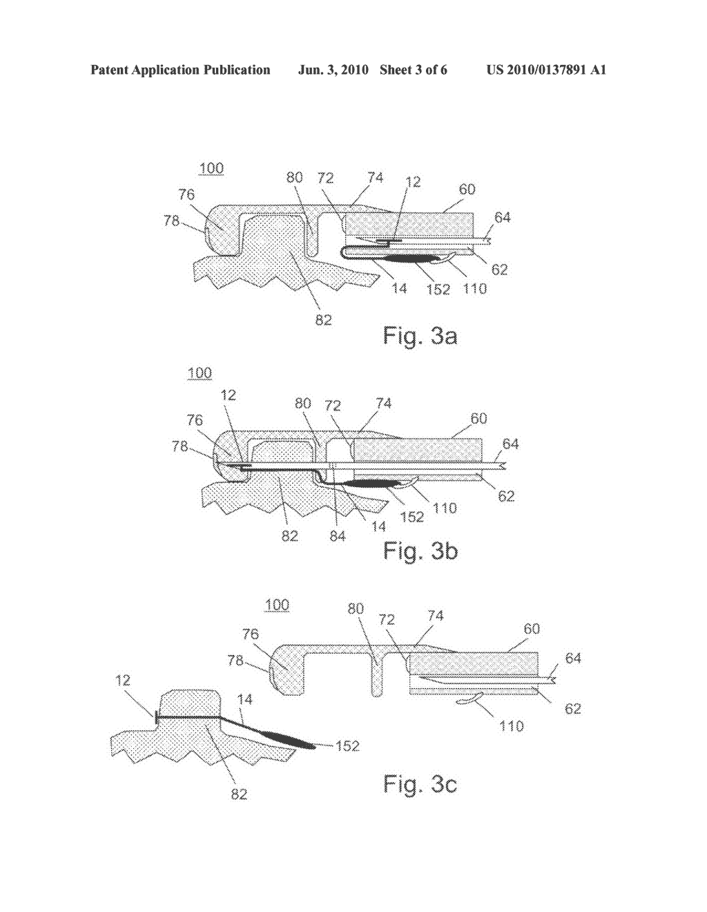 TISSUE ANCHORABLE DEVICES - diagram, schematic, and image 04